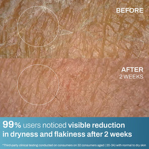 Moisture Crème for Normal-Dry Skin