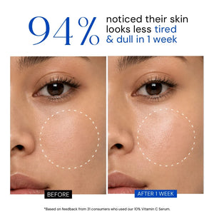 Youth Radiance Serum with 10% Vitamin C + Ferulic Acid