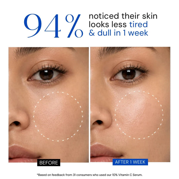 Youth Radiance Serum with 10% Vitamin C + Ferulic Acid