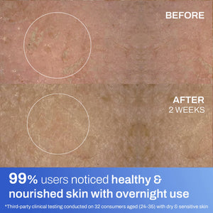 Soothing Crème for Dry & Sensitive Skin