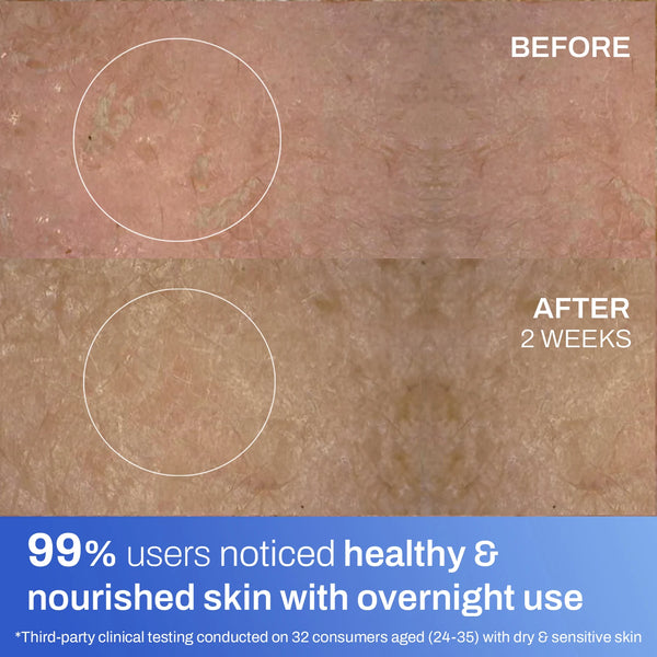 Soothing Crème for Dry & Sensitive Skin