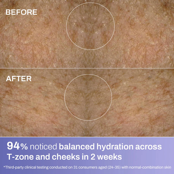 Hydration Crème for Normal-Combination Skin