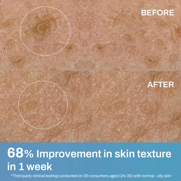 Gel Crème for Normal-Oily Skin