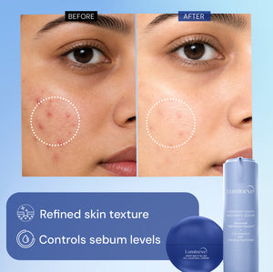 10% Vitamin C Serum + Oil Control Crème