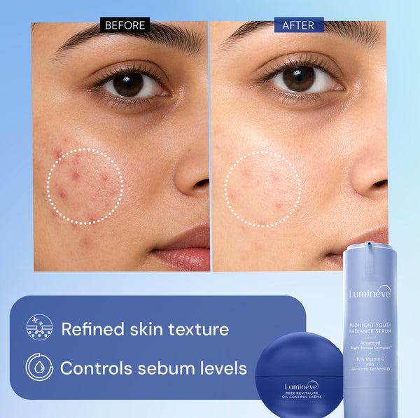 10% Vitamin C Serum + Oil Control Crème