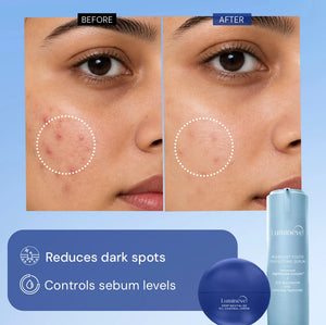 10% Niacinamide Serum + Oil Control Crème