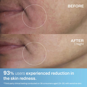 Balanced Barrier Crème for Sensitive Skin