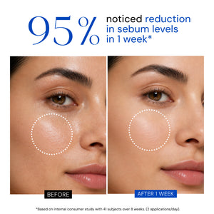 Youth Clarifying Serum with 2% Salicylic Acid + Zinc PCA