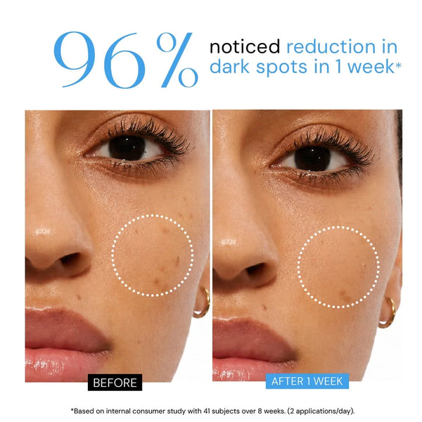Youth Perfecting Serum with 10% Niacinamide + Alpha Arbutin