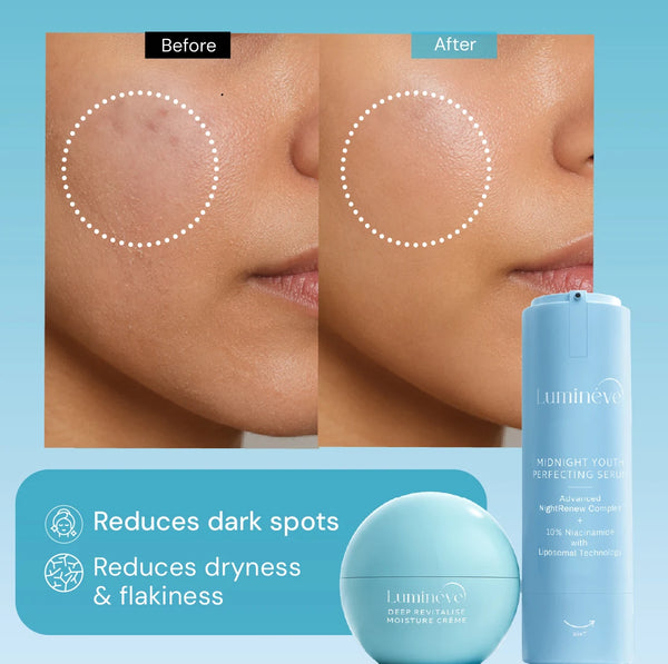 10% Niacinamide Serum + Moisture Crème