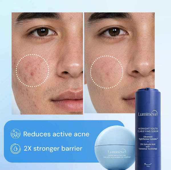 2% Salicylic Acid Serum + Balanced Barrier Crème