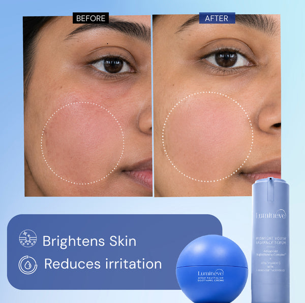 10% Vitamin C Serum + Soothing Crème