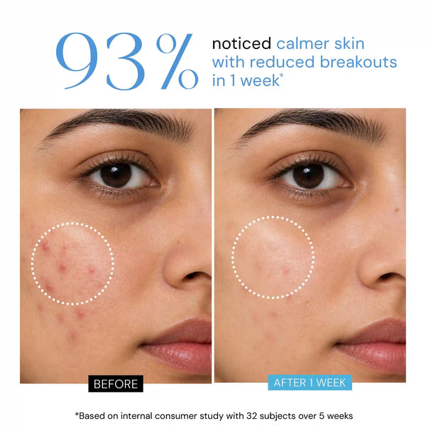 Deep Revitalise Gel Moisturizer with Niacinamide
