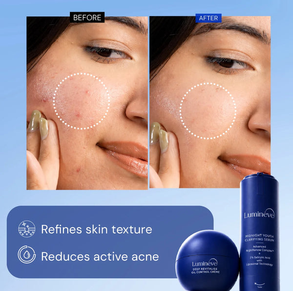 2% Salicylic Acid Serum + Oil Control Crème