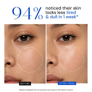 Youth Radiance Serum with 10% Vitamin C + Ferulic Acid