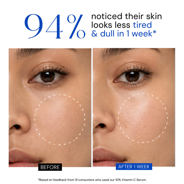 Youth Radiance Serum with 10% Vitamin C + Ferulic Acid