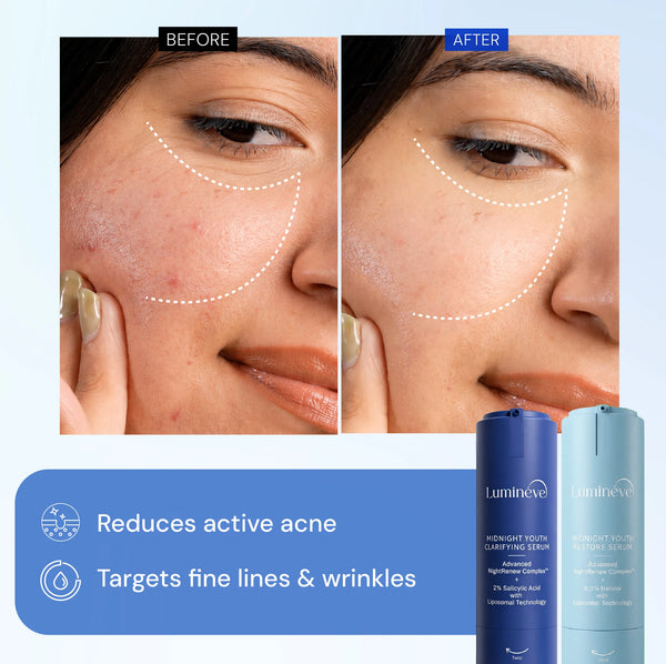 2% Salicylic Acid Serum + 0.3% Retinol Serum