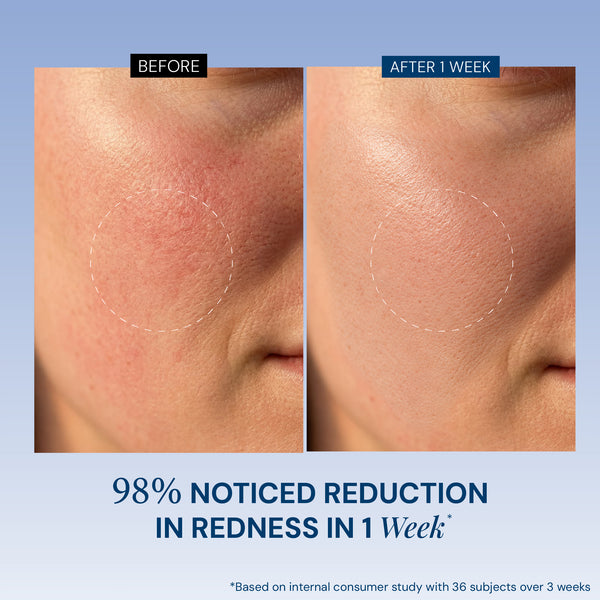 Moisture Balance Cream Cleanser with D-Panthenol + Ectoin | Suitable For Dry & Sensitive Skin