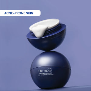 Oil Control Crème for Oily-Acne Prone Skin